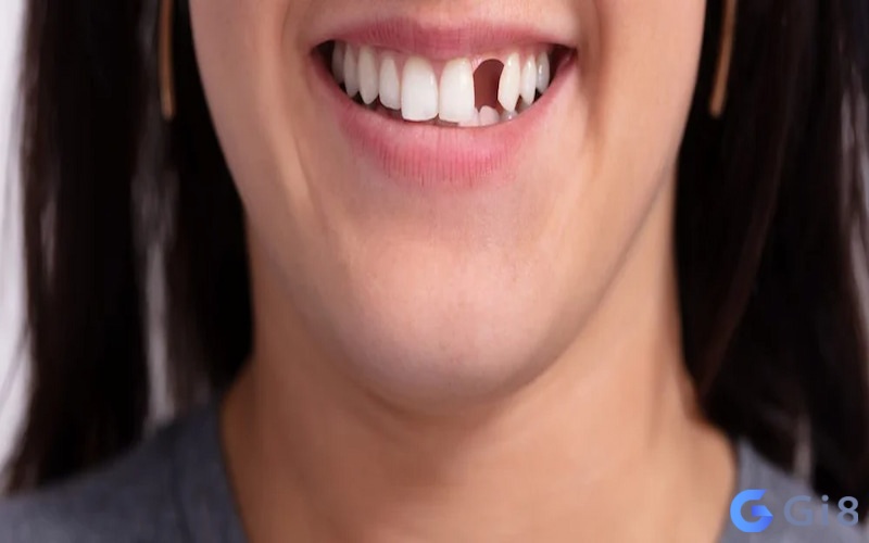 Mơ thấy gãy răng cũng có thể là biểu hiện chứng trầm cảm, nếu mơ thấy gãy răng đánh con gì mới dễ ăn?