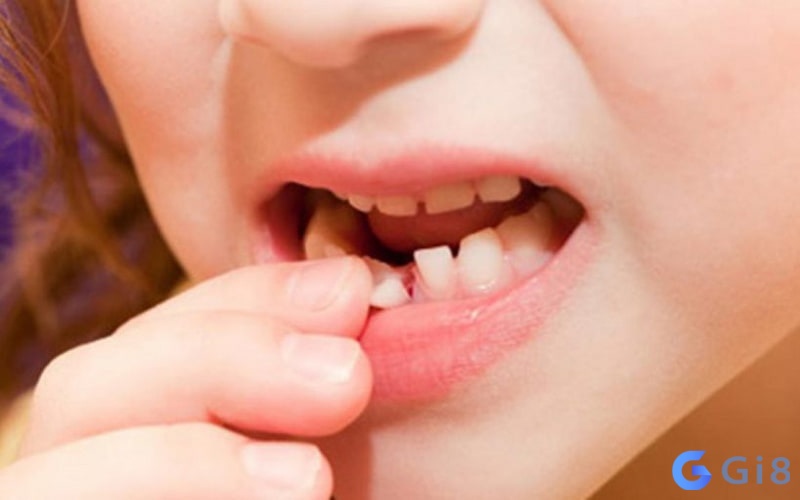 Mất một chiếc răng hàm dưới là báo hiệu người thân không khỏe. Mơ thấy gãy răng đánh con gì?